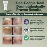 Treat Nails & Kill 99% Of Bacteria With 2x Faster Acting Formula Using NoMore™