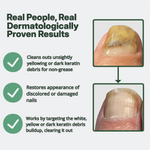 Treat Nails & Kill 99% Of Bacteria With 2x Faster Acting Formula Using NoMore™