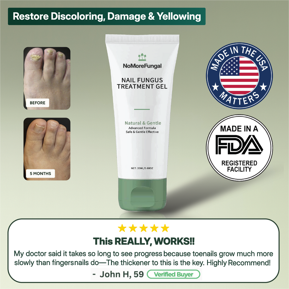 Treat Nails & Kill 99% Of Bacteria With 2x Faster Acting Formula Using NoMore™